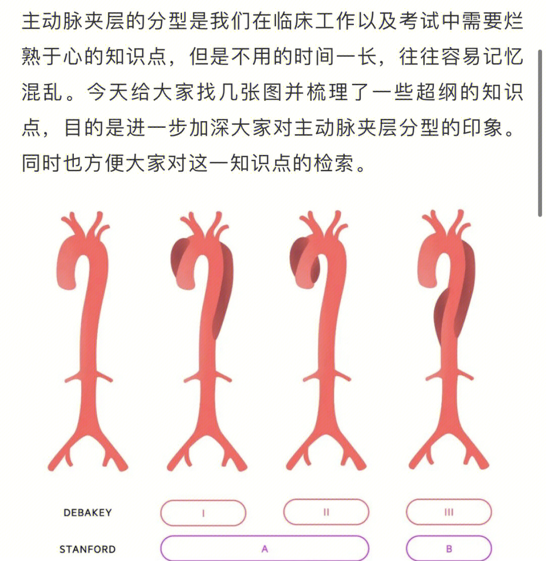 主动脉夹层分型