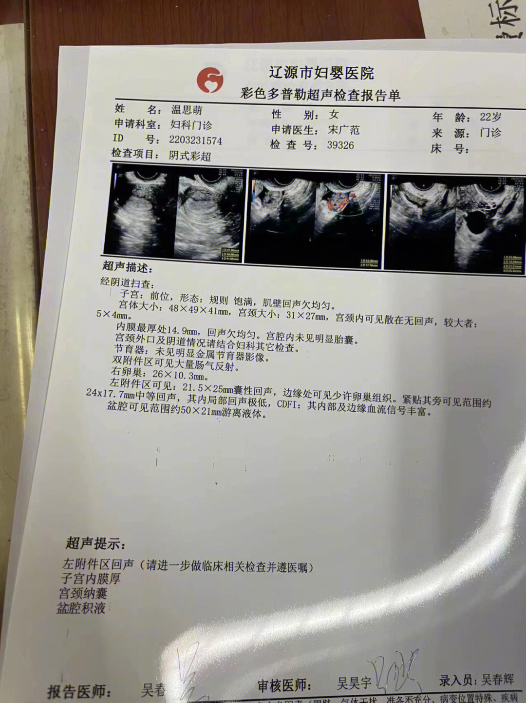 宫外孕检查图片