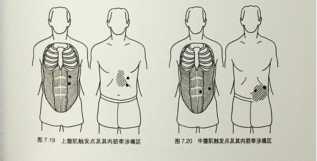 腹直肌外缘体表定位图片