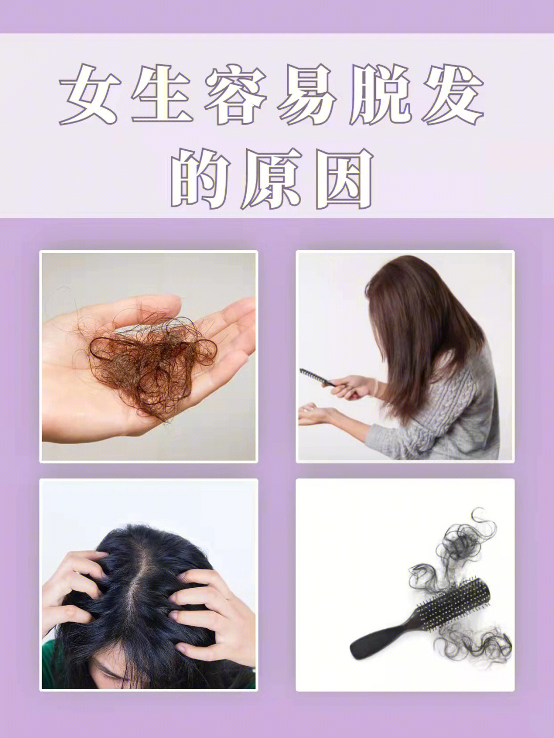 女生容易脱发的原因