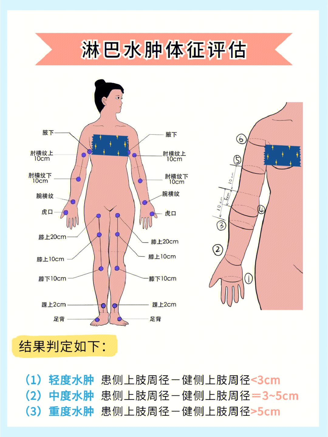 腿淋巴在哪个位置图片图片