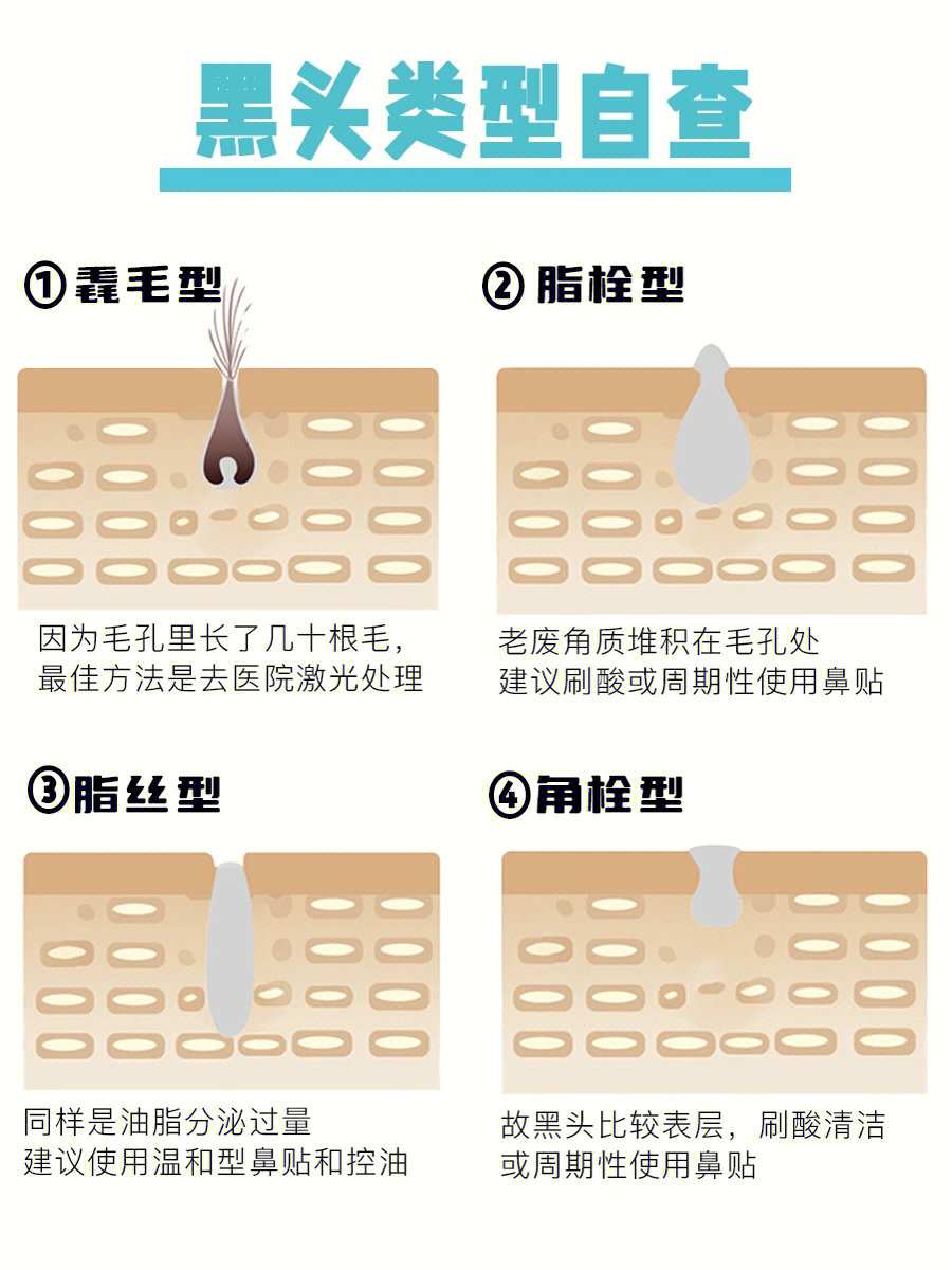 脂质微丝和黑头区别图片