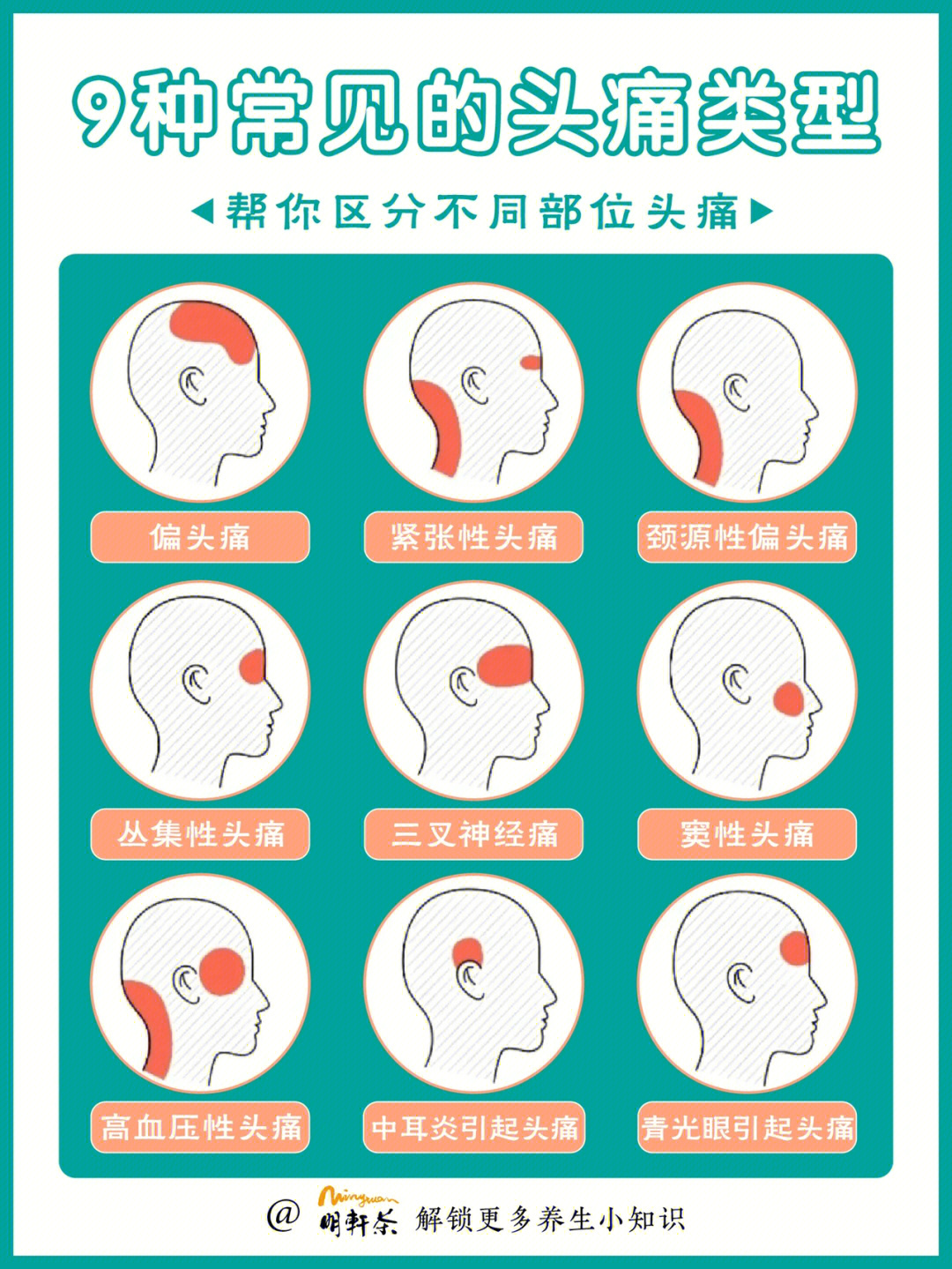 各种头痛位置图图片