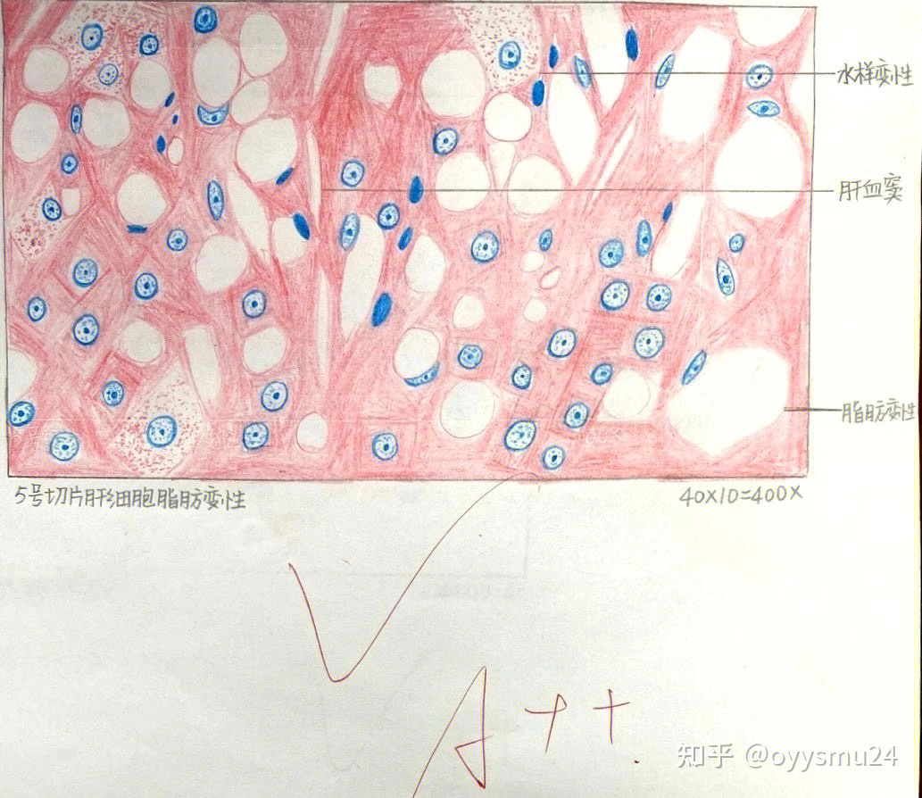 伤寒杆菌红蓝铅笔绘图图片