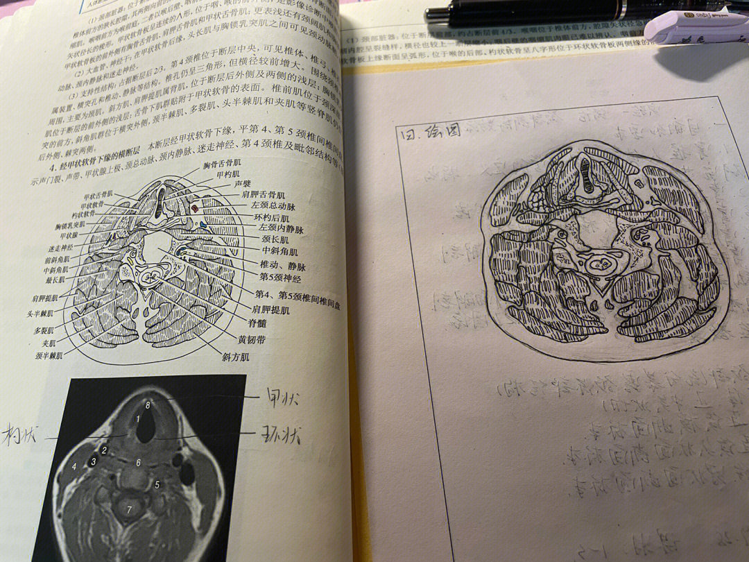 横断面图怎么画手绘图片