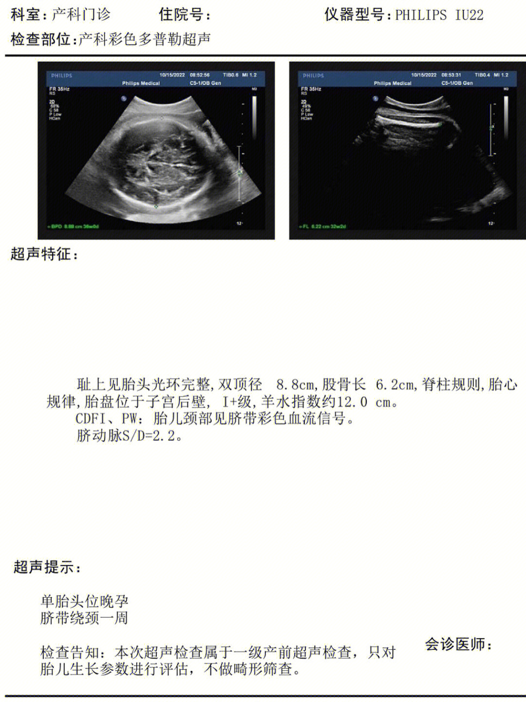 胎儿股骨短6周出生图片