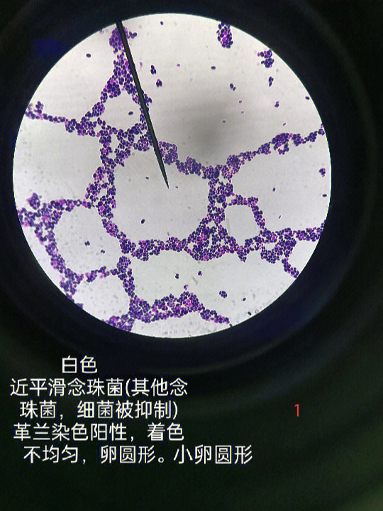 念珠菌显微镜下图片图片