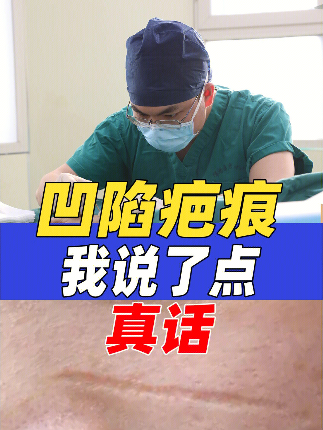 针对凹陷性疤痕,其实形成了根本不可能修复的和正常皮肤一模一样,因为