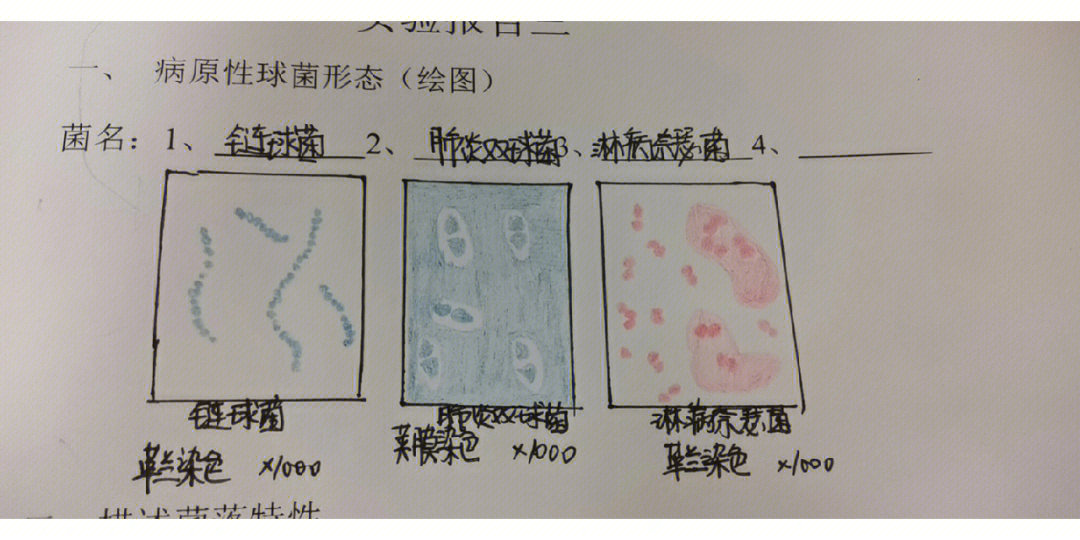 肺炎双球菌荚膜图片