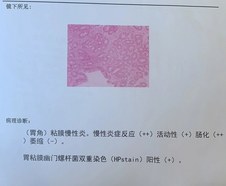 报告,第一句就说你还这么年轻…直接把我吓住了,萎缩性胃炎c3伴肠化