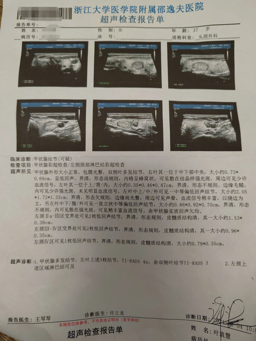 甲状腺穿刺报告解读图片