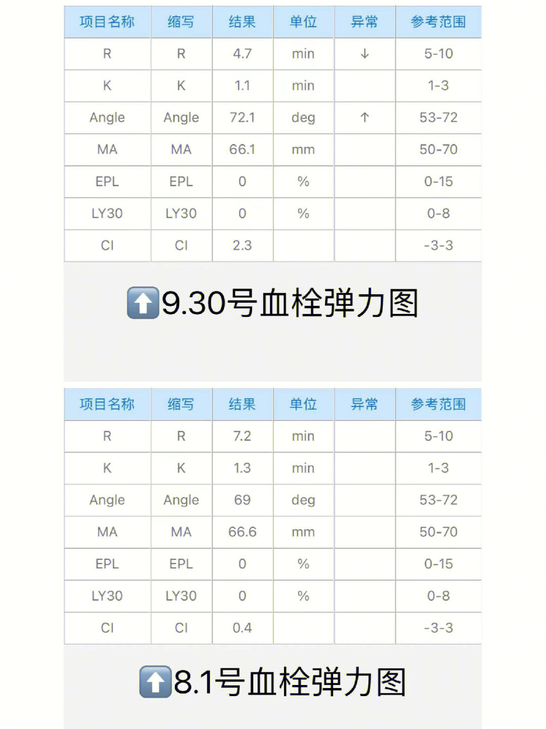 麻烦懂得的人帮我看一下凝血功能