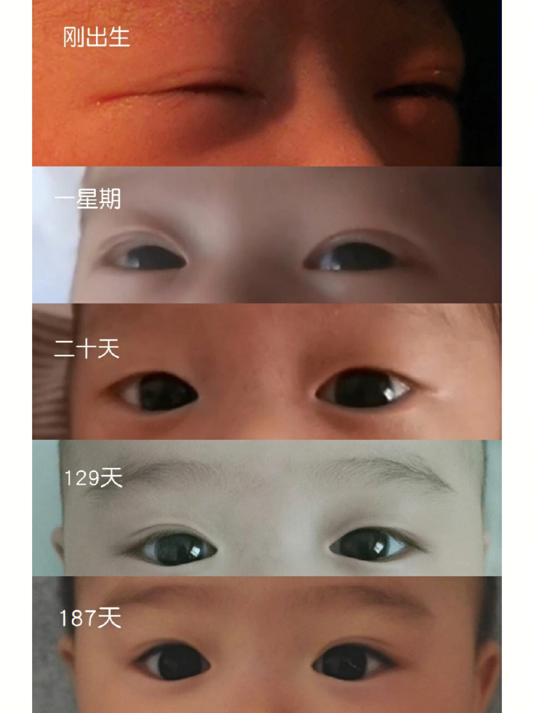 婴儿双眼皮的线条图图片
