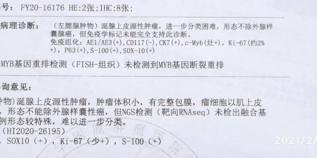 腺癌 实验报告图片