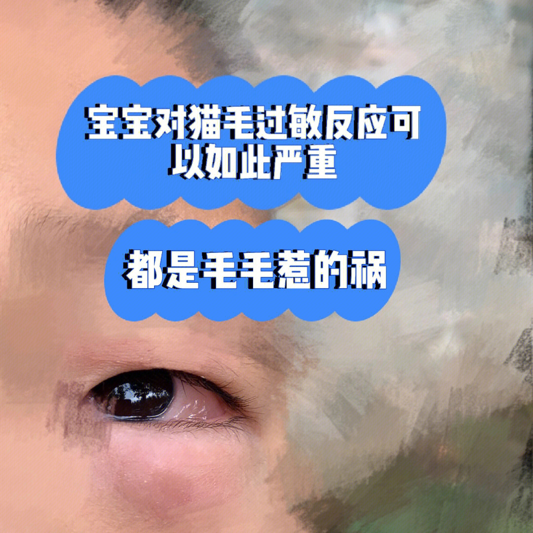 毛毛眼功效图片