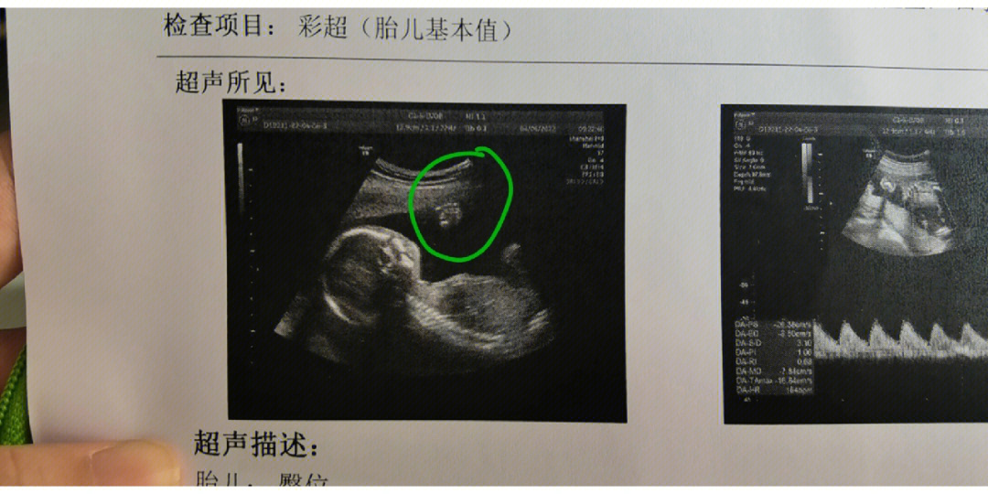 22周子宫位置正常图图片