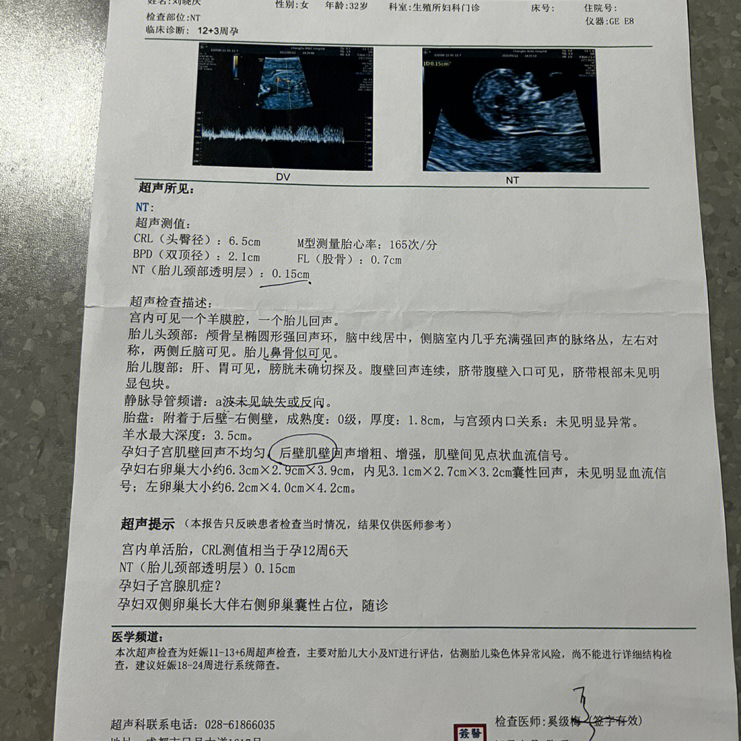 胎儿鼻骨长标准对照表图片