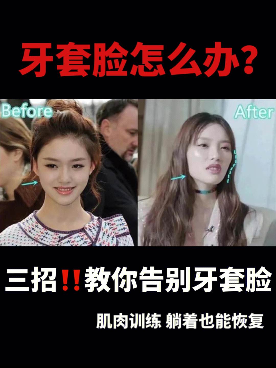 容易成牙套脸的年龄图片