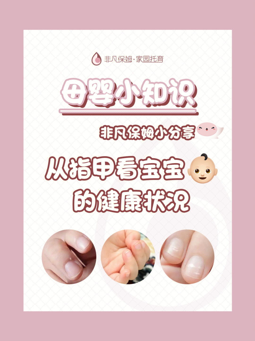 宝宝的指甲在正常情况下应该呈现出粉嫩嫩的颜色,而且表面光滑,透亮