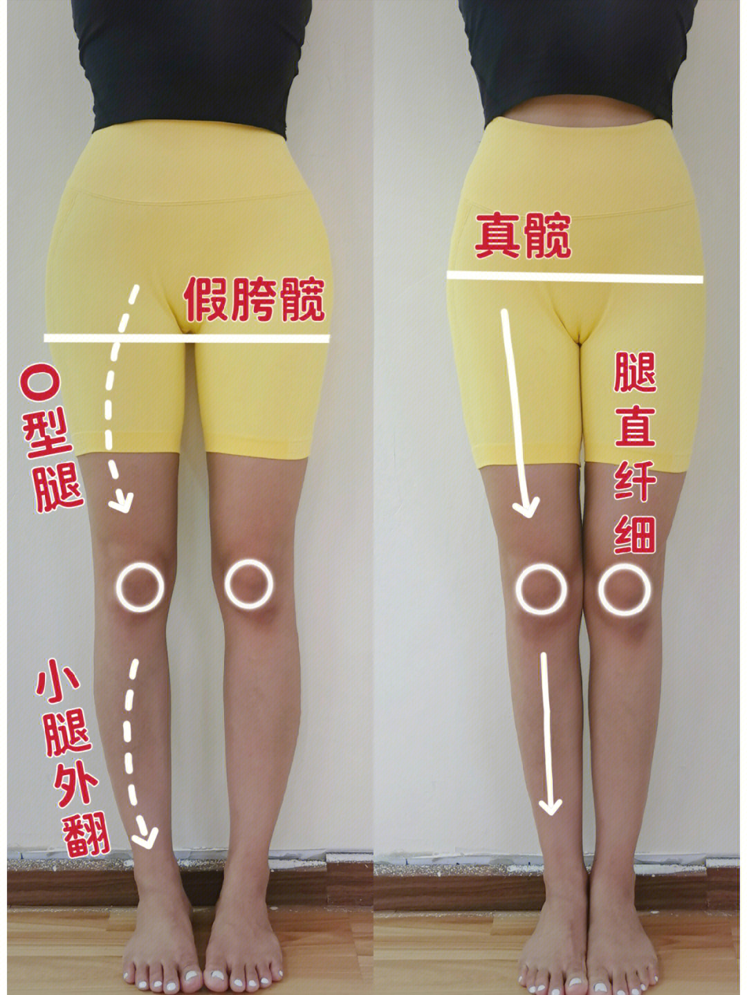 改善o型腿的动作图解图片