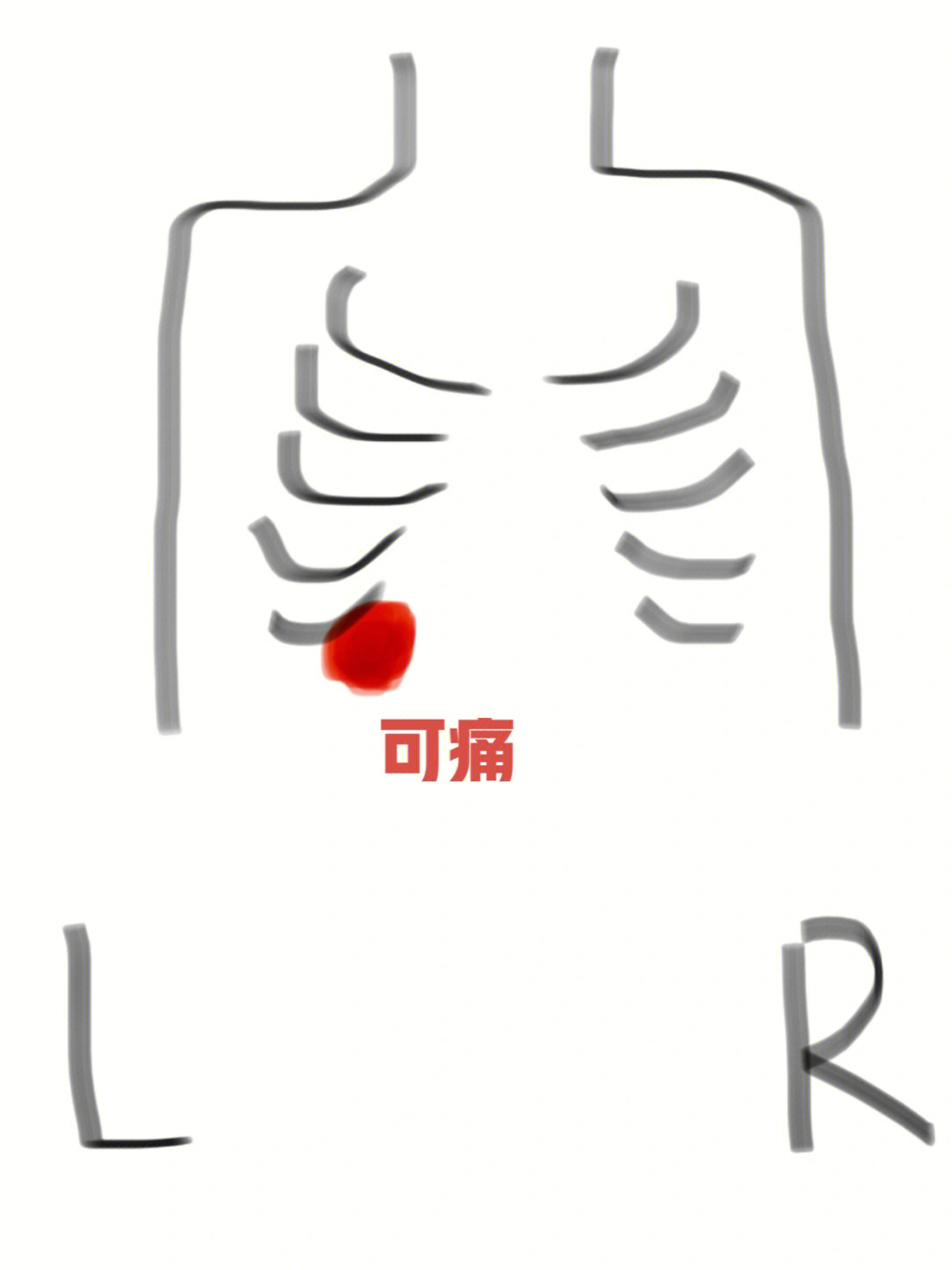 女性左胸下方肋骨疼痛图片