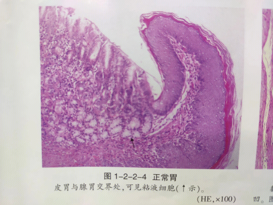 胃的切片结构图片图片