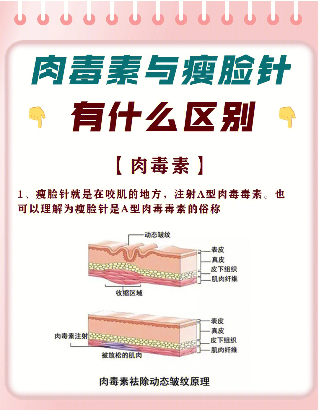 肉毒素注射方法图片