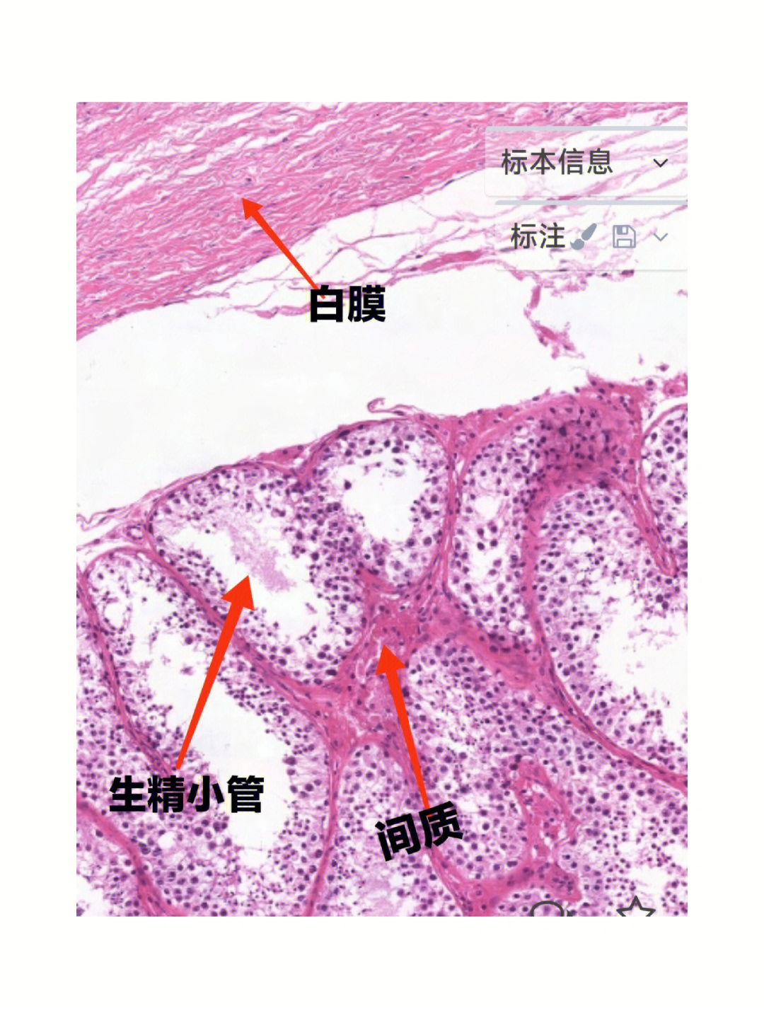 组胚睾丸画图图片