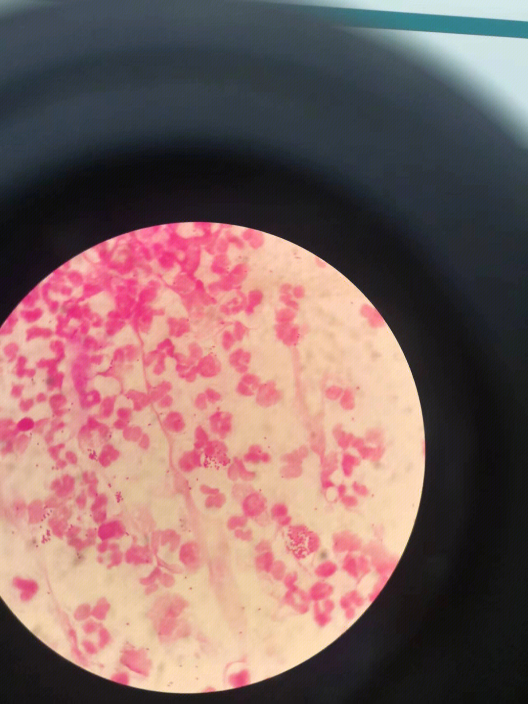 淋病奈瑟菌菌落形态图片