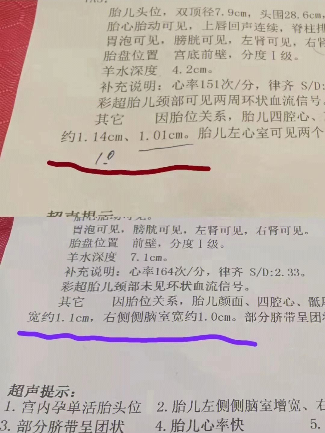 艾聪宝说明书图片