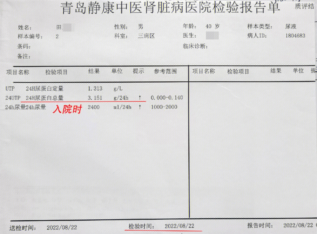 肾综患者24小时尿蛋白总量3151g降至正常