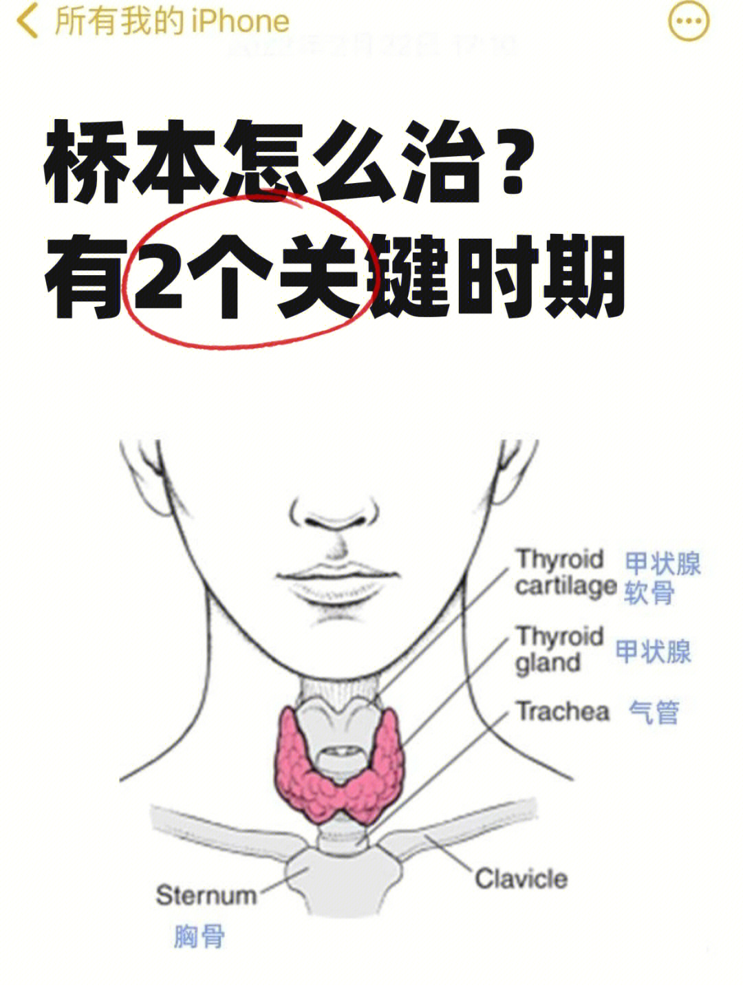 桥本甲状腺炎怎么治把握2个关键时期