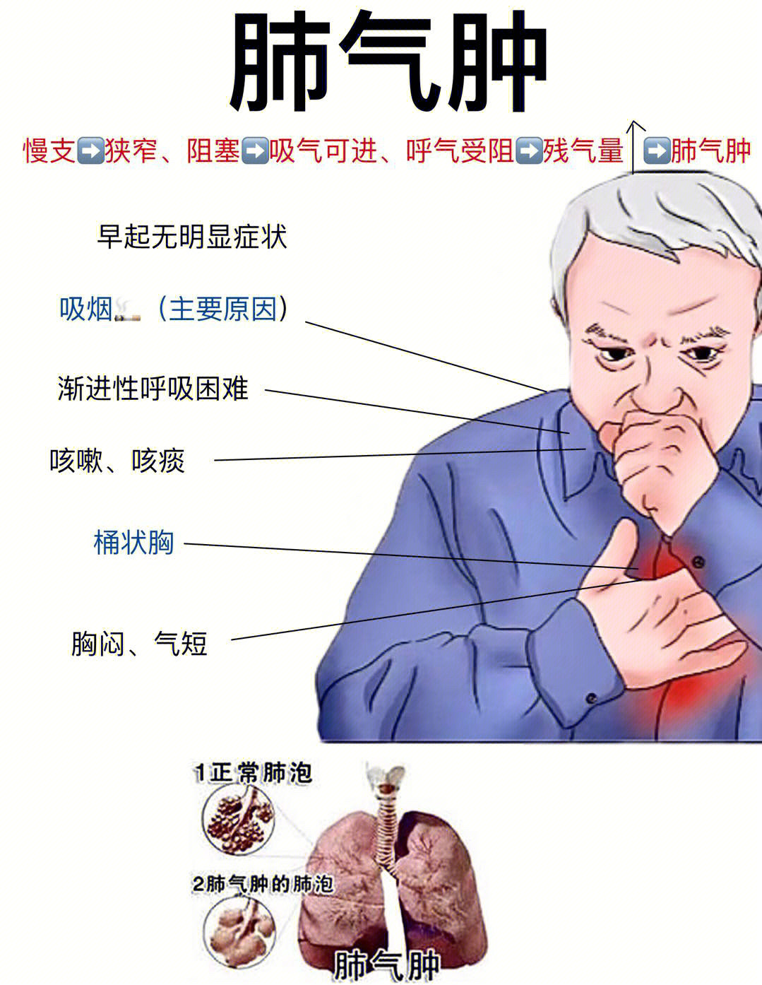 慢阻肺的病因图片