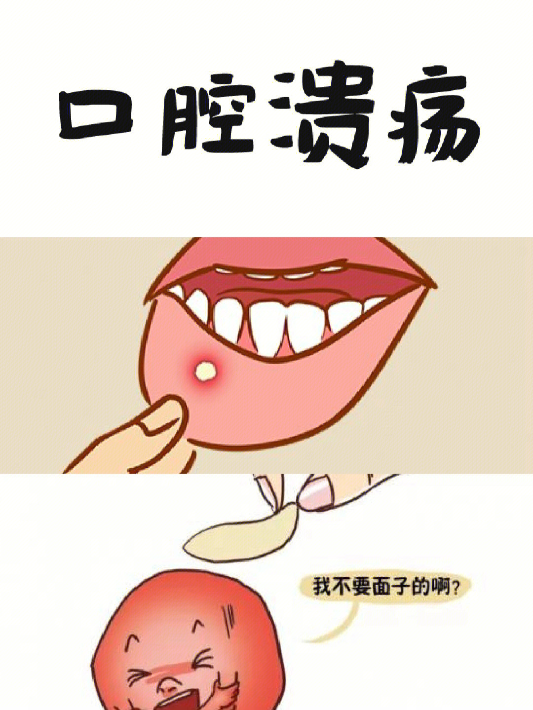 多见于唇内侧,舌头,舌腹,颊黏膜,前庭沟,软腭等部位,舌头溃疡指发生于