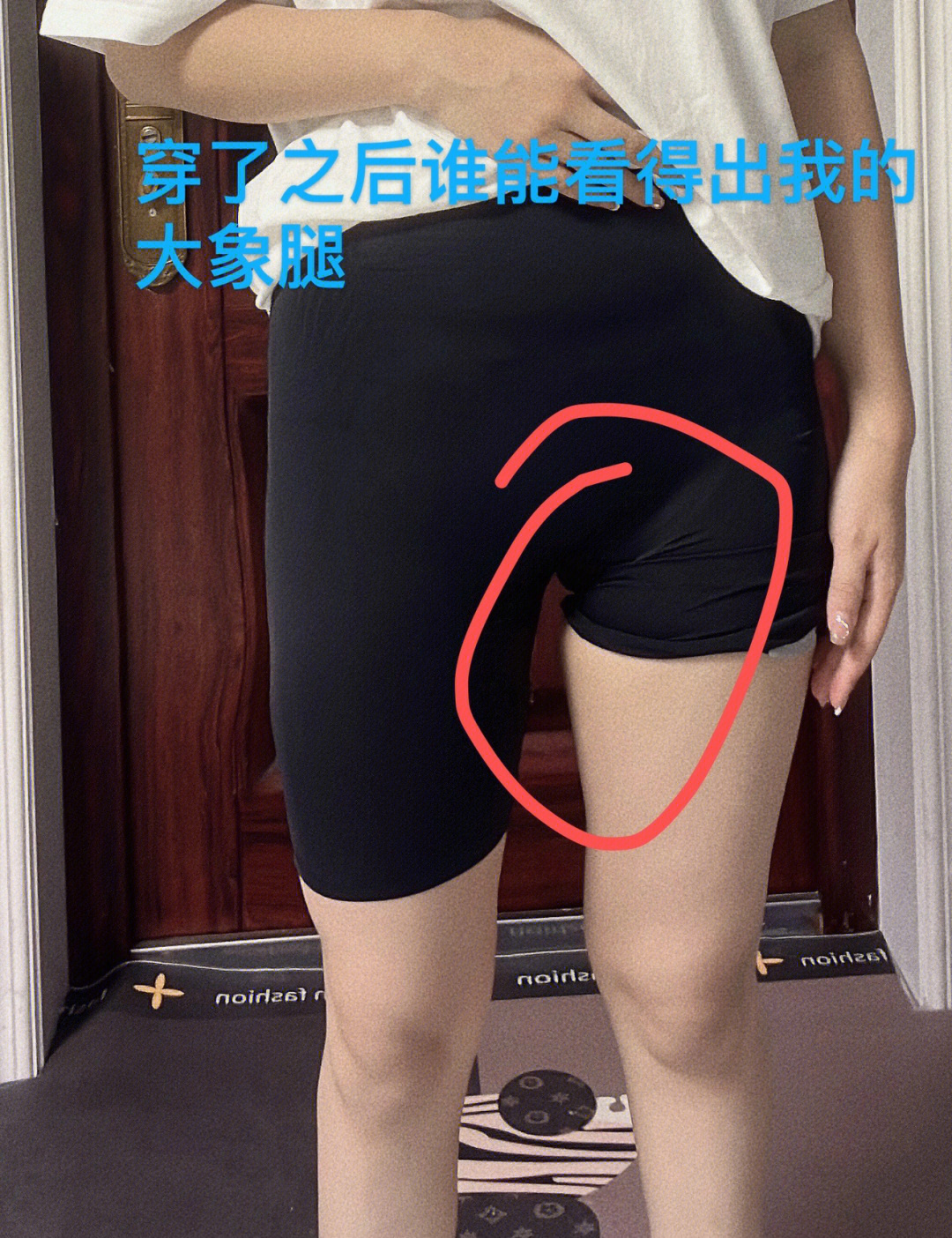 大腿内侧黑色凸起疙瘩图片