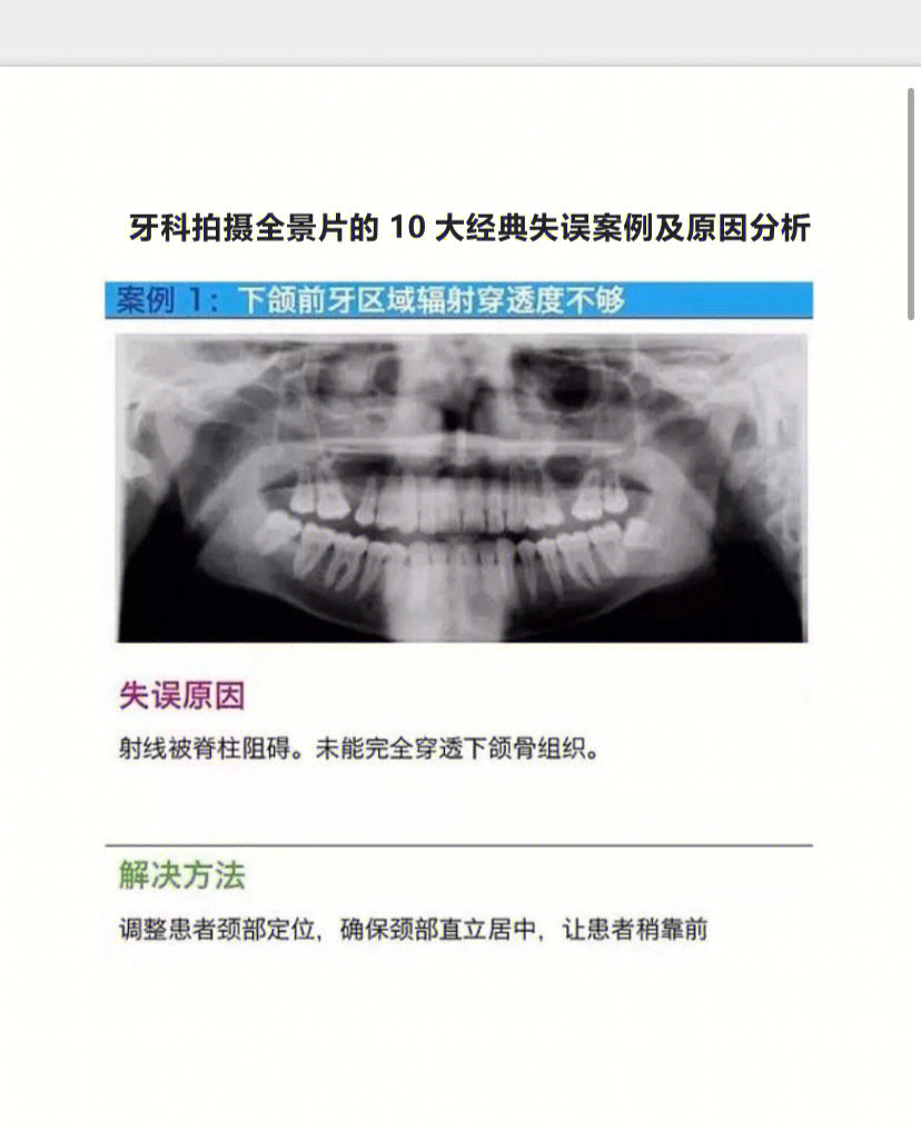 全景牙片报告模板图片