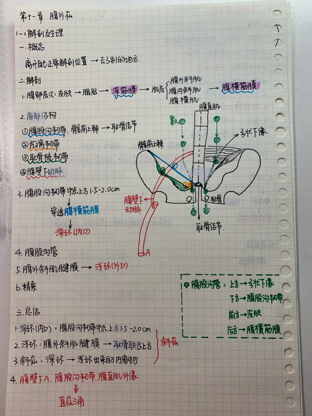 腹外疝分类图片