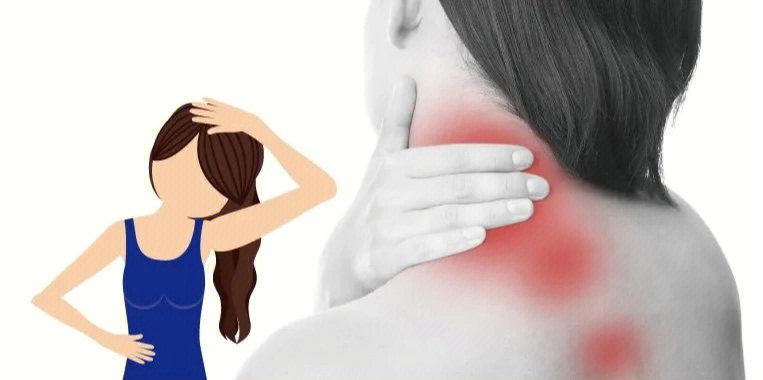 肩颈僵硬疼痛2个动作有效纾解