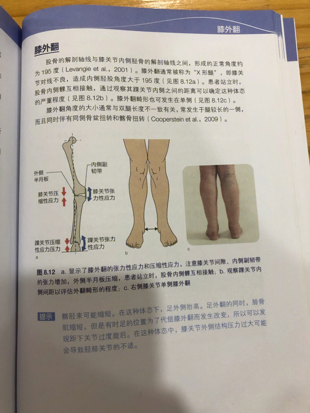 小腿外翻最快纠正法图片