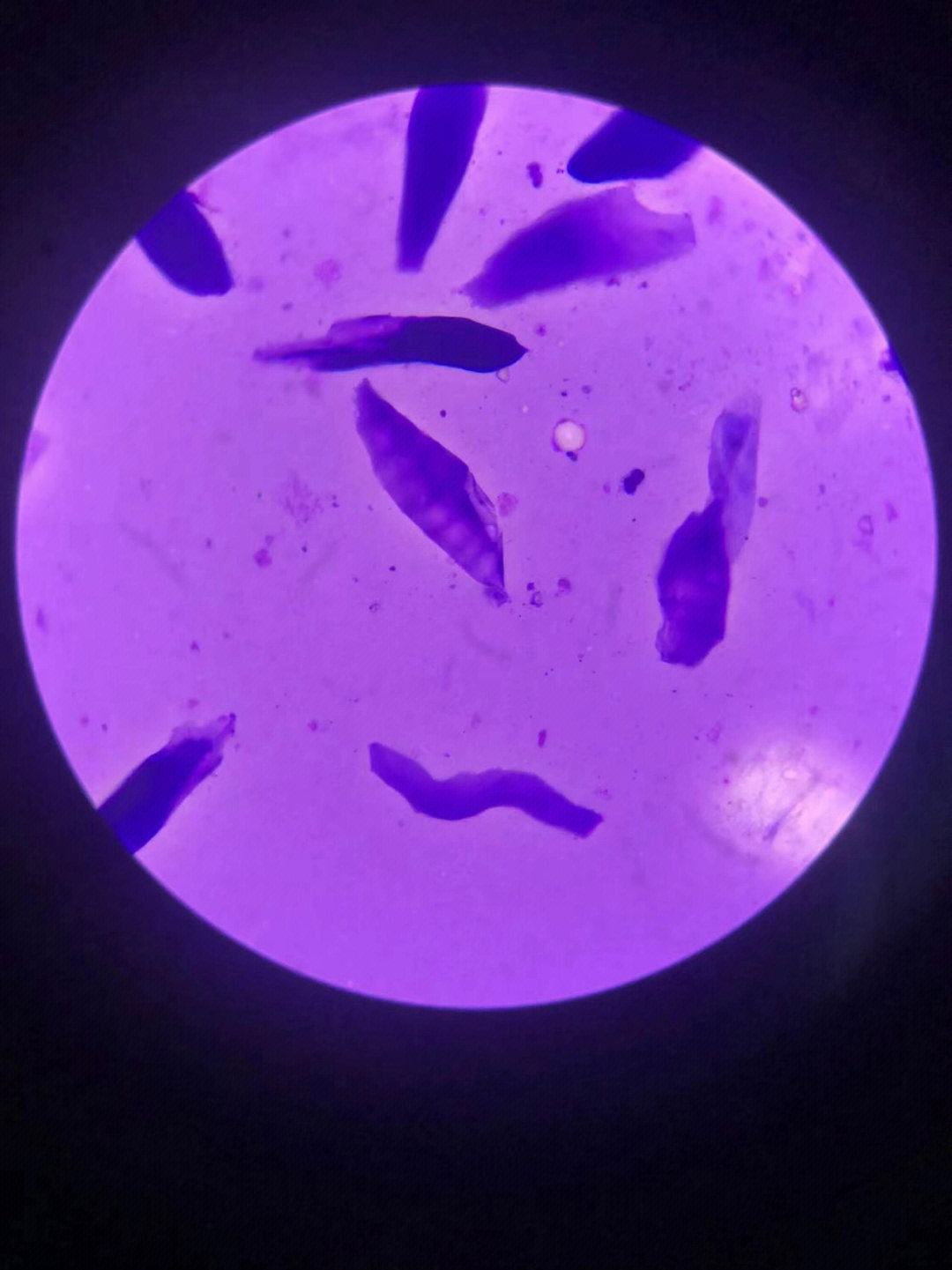 犬小孢子菌镜检图片图片