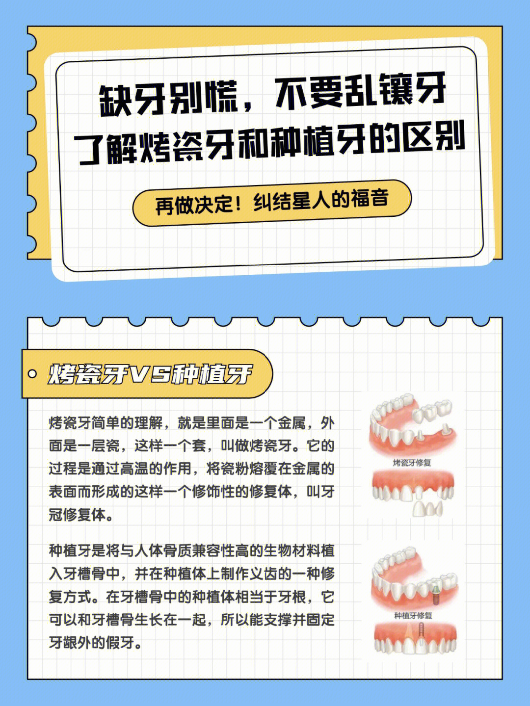 566大点带你了解烤瓷牙和种植牙的区别