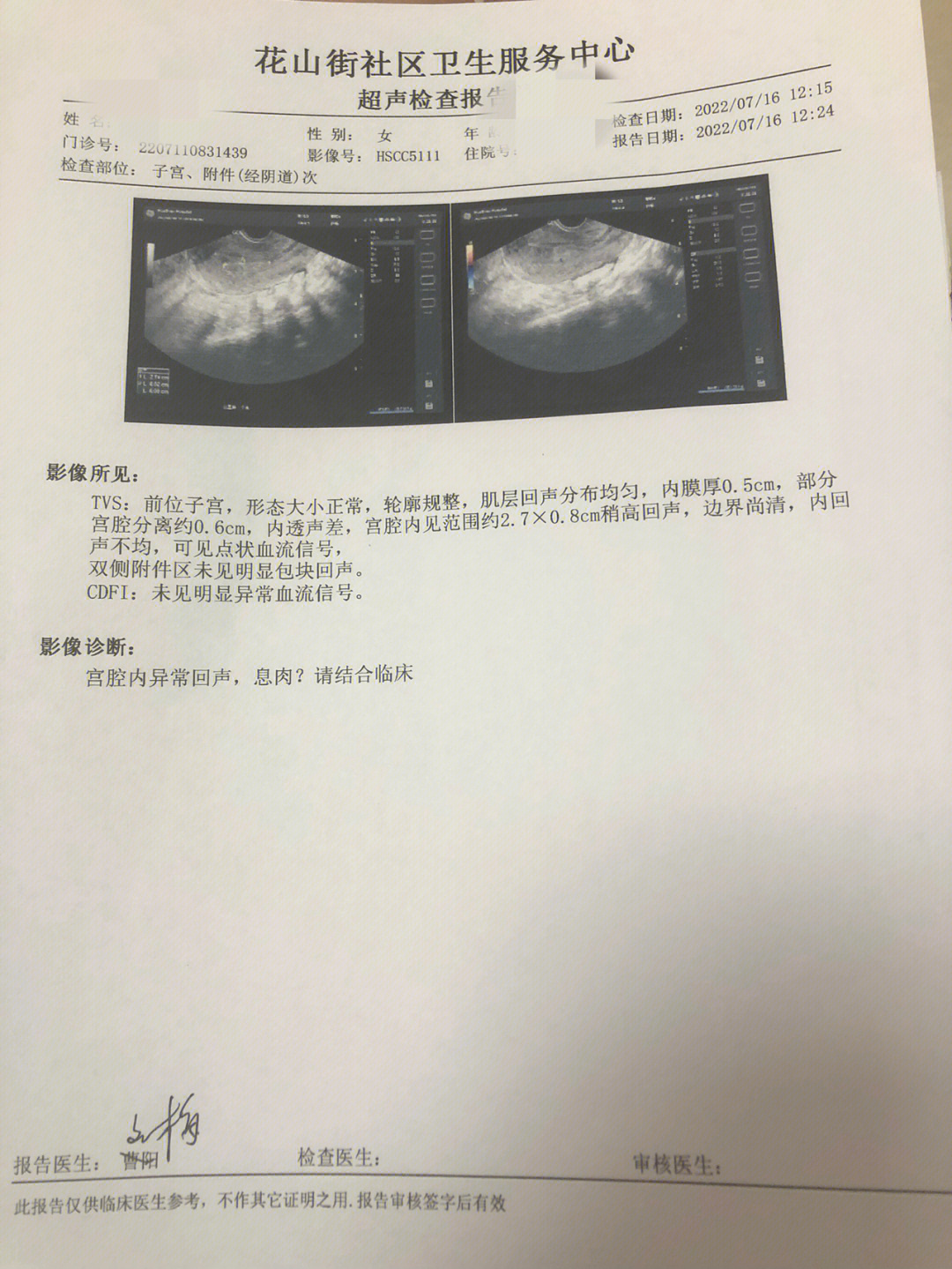 宫颈息肉病理报告图片