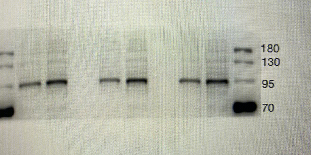 westernblot原图图片