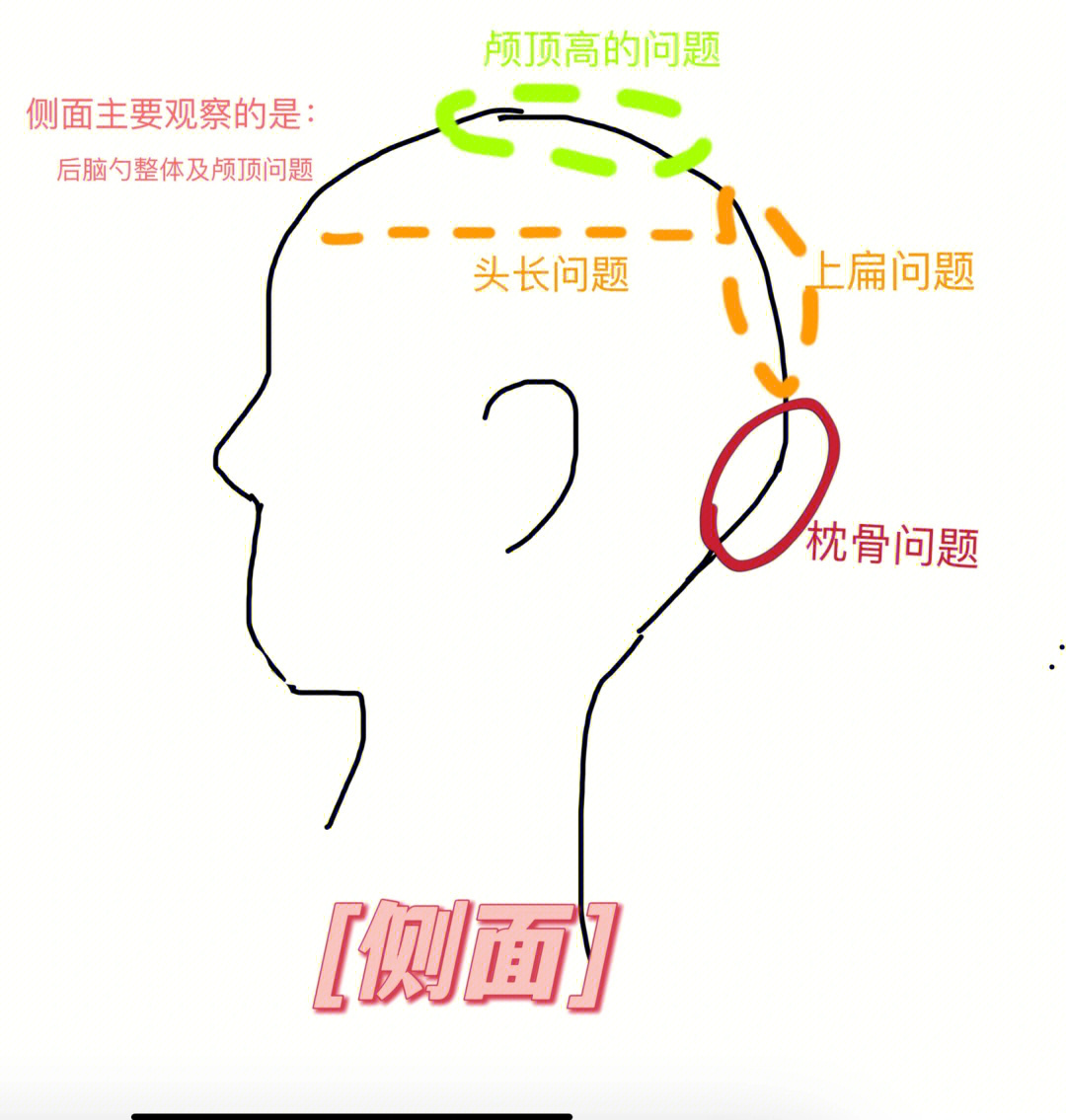 后脑勺反骨图片女人图片