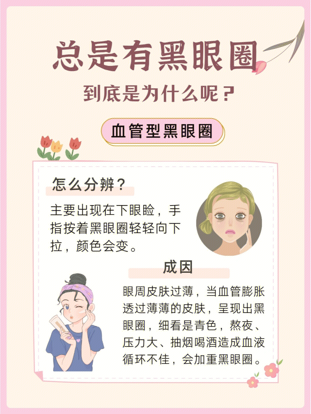 黑眼圈的另一种说法图片