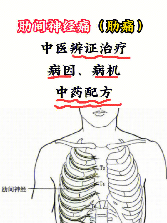 9898本病临床表现主要是胸胁疼痛,可轻可重,有时呈放射状,原发性