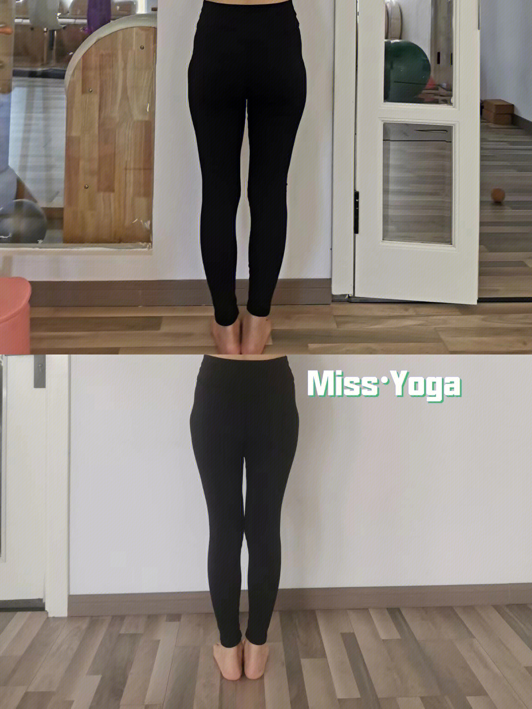 missyoga十节股骨大转子半脱位