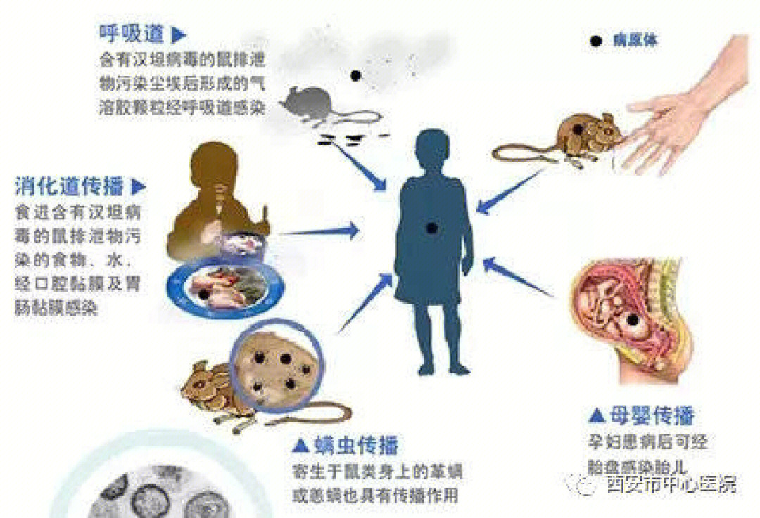 出血热死亡率图片