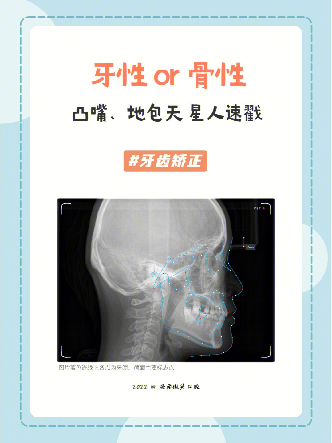 骨性和牙性的区别图片