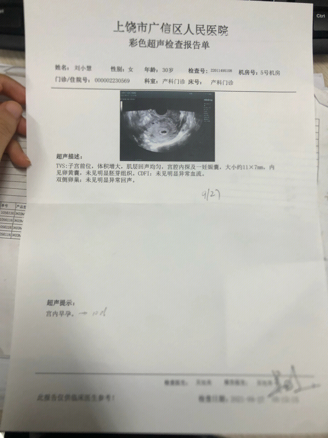 孕十周听胎心位置图片图片